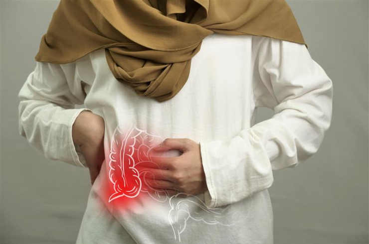 Appendectomy