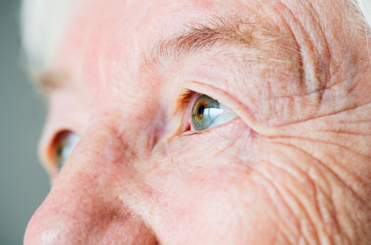 Glaucoma Surgery