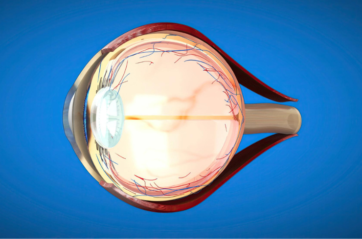 Retina Surgery